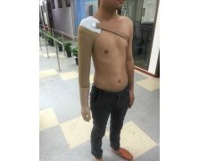 上臂美觀手